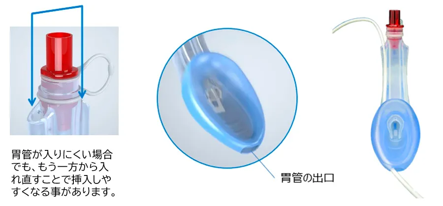 ガストリックアクセス
